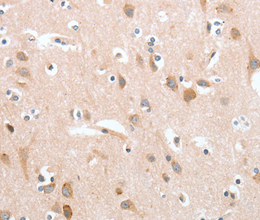 Immunohistochemistry of paraffin-embedded Human brain tissue using cPLA2 Polyclonal Antibody at dilution 1:40