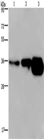 Western Blot analysis of Human breast infiltRative duct and fetal brain tissue, Mouse brain tissue   using CUEDC2 Polyclonal Antibody at dilution of 1:600