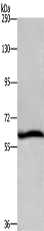 Western Blot analysis of Hela cell using DCP1A Polyclonal Antibody at dilution of 1:1100