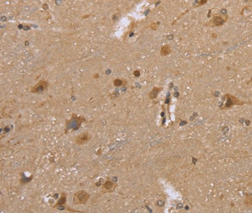 Immunohistochemistry of paraffin-embedded Human brain tissue using DLD Polyclonal Antibody at dilution 1:35