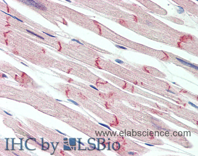 Immunohistochemistry of paraffin-embedded Heart tissue using DSG2 Polyclonal Antibody at dilution of 1:150.