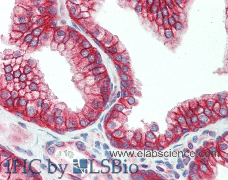 Immunohistochemistry of paraffin-embedded Prostate tissue using DSG2 Polyclonal Antibody at dilution of 1:150.