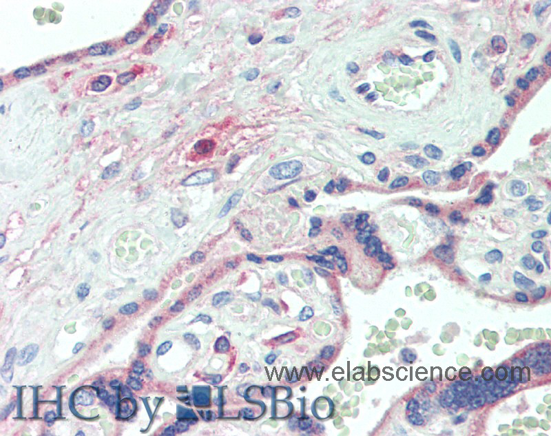 Immunohistochemistry of paraffin-embedded Placenta tissue using DLL4 Polyclonal Antibody at dilution of 1:60.