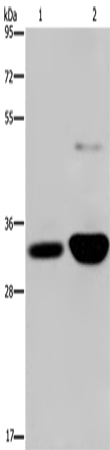 Western Blot analysis of Human fetal brain and Mouse brain tissue using MAPRE3 Polyclonal Antibody at dilution of 1:500