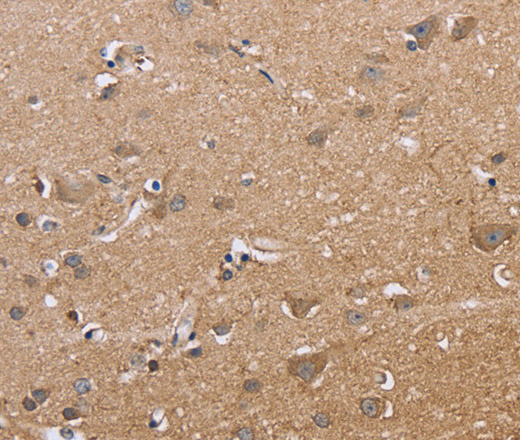 Immunohistochemistry of paraffin-embedded Human brain using MAPRE3 Polyclonal Antibody at dilution of 1:50