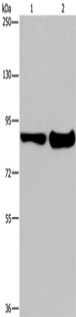 Western Blot analysis of Mouse lung and liver tissue using MAPRE3 Polyclonal Antibody at dilution of 1:1050