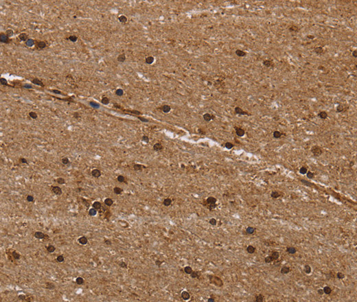 Immunohistochemistry of paraffin-embedded Human brain  using EIF3H Polyclonal Antibody at dilution of 1:50