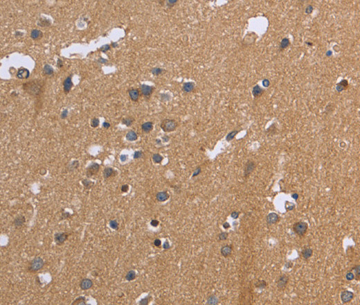 Immunohistochemistry of paraffin-embedded Human brain  tissue using KIAA1324 Polyclonal Antibody at dilution 1:30