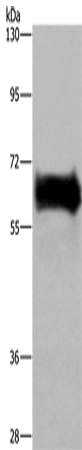 Western Blot analysis of Mouse kidney tissue using EZR Polyclonal Antibody at dilution of 1:300