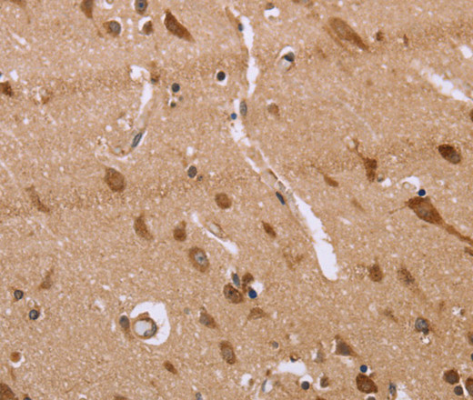 Immunohistochemistry of paraffin-embedded Human brain  tissue using FAAH2 Polyclonal Antibody at dilution 1:30