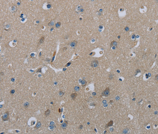 Immunohistochemistry of paraffin-embedded Human brain  using FAAH Polyclonal Antibody at dilution of 1:50