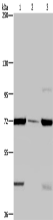 Western Blot analysis of LoVo cell, Human testis tissue and A549 cell using FAAH Polyclonal Antibody at dilution of 1:400