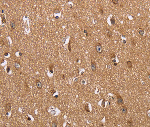 Immunohistochemistry of paraffin-embedded Human brain  tissue using FABP6 Polyclonal Antibody at dilution 1:30