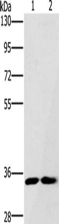 Western Blot analysis of A172 and Raji cell using FAIM2 Polyclonal Antibody at dilution of 1:500