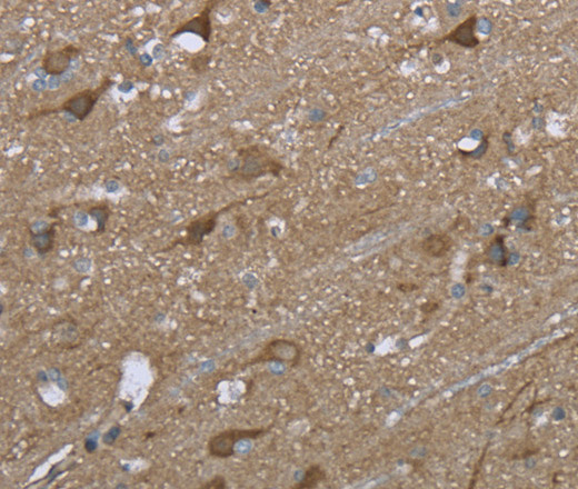 Immunohistochemistry of paraffin-embedded Human brain using PTK2B Polyclonal Antibody at dilution of 1:50