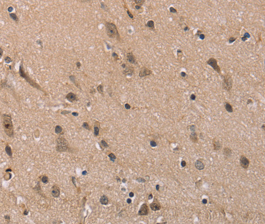 Immunohistochemistry of paraffin-embedded Human brain  tissue using FAM107A Polyclonal Antibody at dilution 1:30