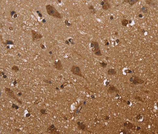 Immunohistochemistry of paraffin-embedded Human brain  tissue using FANCF Polyclonal Antibody at dilution 1:60