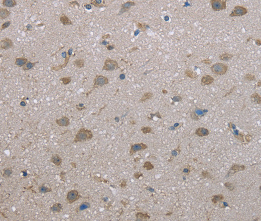 Immunohistochemistry of paraffin-embedded Human brain tissue using FAP Polyclonal Antibody at dilution 1:30