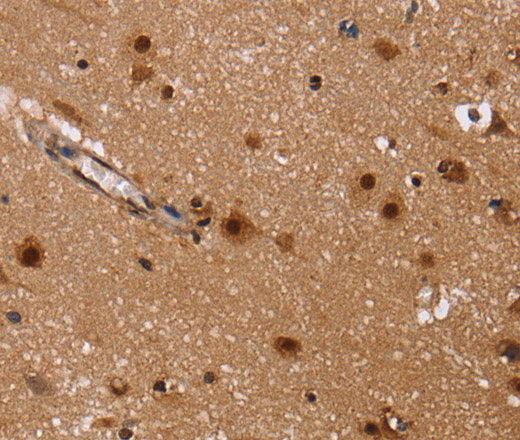 Immunohistochemistry of paraffin-embedded Human brain  tissue using FASTKD5 Polyclonal Antibody at dilution 1:40