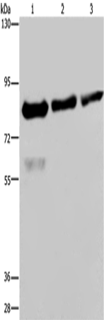 Western Blot analysis of Hela, LoVo and HepG2 cell using FASTKD2 Polyclonal Antibody at dilution of 1:500