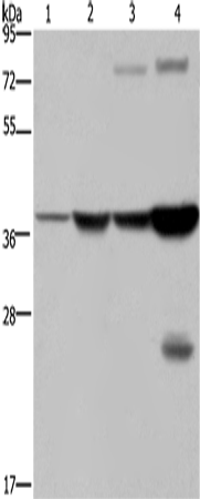 Western Blot analysis of Mouse stomach and Human fetal liver tissue, MCF-7 cell and Mouse liver tissue using FBP1 Polyclonal Antibody at dilution of 1:550