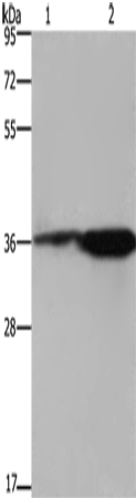 Western Blot analysis of 293T cell and Mouse brain tissue using CD89 Polyclonal Antibody at dilution of 1:550