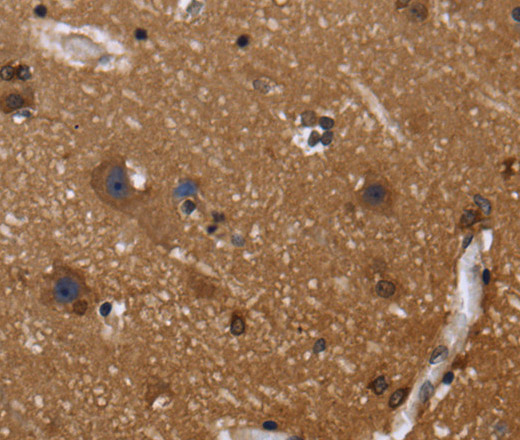 Immunohistochemistry of paraffin-embedded Human brain using FGFR1OP Polyclonal Antibody at dilution of 1:40