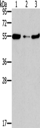 Western Blot analysis of Mouse heart tissue and NIH/3T3 cell, Mouse liver tissue using FGFR1OP Polyclonal Antibody at dilution of 1:850