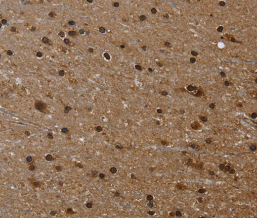 Immunohistochemistry of paraffin-embedded Human brain  using FLNA Polyclonal Antibody at dilution of 1:50