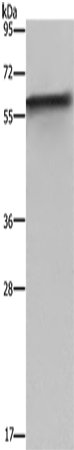 Western Blot analysis of Mouse liver tissue using FKBP8 Polyclonal Antibody at dilution of 1:1150