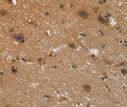 Immunohistochemistry of paraffin-embedded Human brain  using FRK Polyclonal Antibody at dilution of 1:40