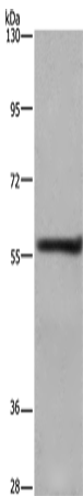 Western Blot analysis of A431 cell using FRK Polyclonal Antibody at dilution of 1:1000