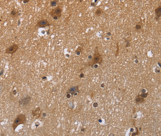 Immunohistochemistry of paraffin-embedded Human brain  tissue using FSTL1 Polyclonal Antibody at dilution 1:40