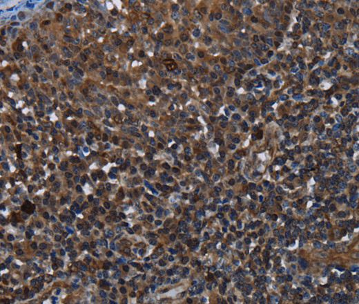 Immunohistochemistry of paraffin-embedded Human tonsil using GALT Polyclonal Antibody at dilution of 1:30