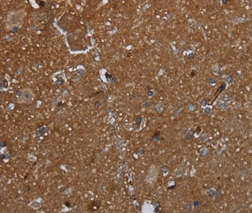 Immunohistochemistry of paraffin-embedded Human brain  using GALT Polyclonal Antibody at dilution of 1:30