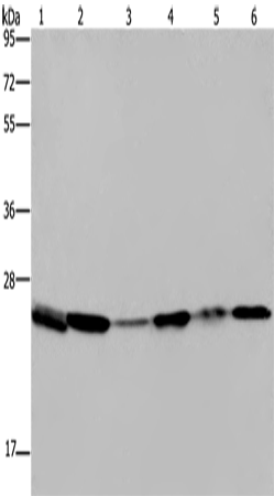 Western Blot analysis of Mouse spleen tissue, A375, A549 and HT-29 cell, Mouse lung and Hela cell using ARHGDIA Polyclonal Antibody at dilution of 1:400