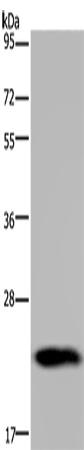 Western Blot analysis of Human placenta tissue using GH2 Polyclonal Antibody at dilution of 1:700