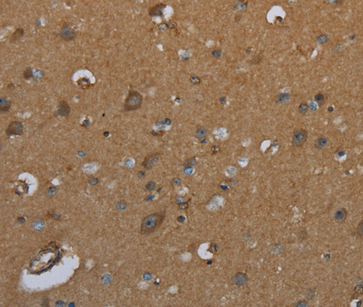 Immunohistochemistry of paraffin-embedded Human brain  tissue using ID2 Polyclonal Antibody at dilution 1:30