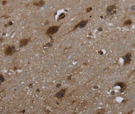 Immunohistochemistry of paraffin-embedded Human brain  tissue using GLIPR1 Polyclonal Antibody at dilution 1:50