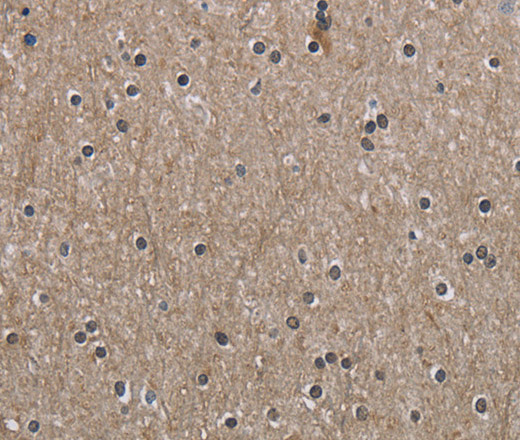 Immunohistochemistry of paraffin-embedded Human brain  using PPAT Polyclonal Antibody at dilution of 1:50