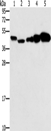 Western Blot analysis of Hela, Raji, Jurkat, A549 and NIH/3T3 cell using PPAT Polyclonal Antibody at dilution of 1:250