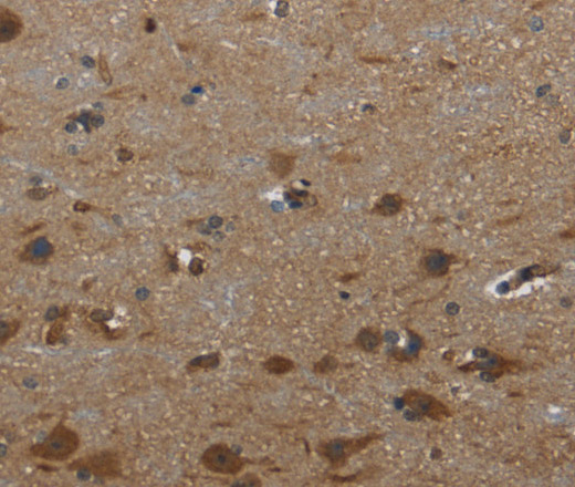 Immunohistochemistry of paraffin-embedded Human brain  using GYS1 Polyclonal Antibody at dilution of 1:40