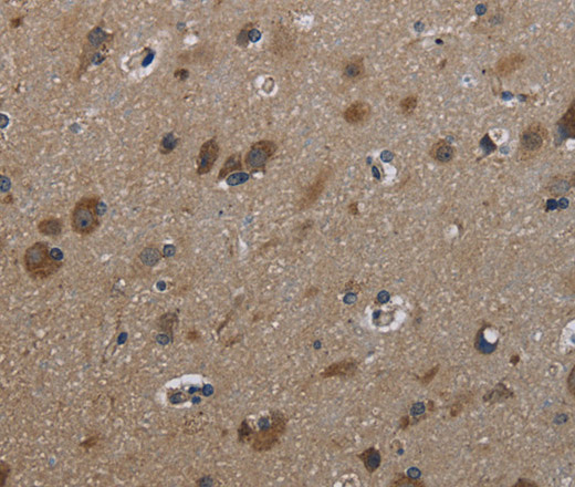 Immunohistochemistry of paraffin-embedded Human brain using GSTA3 Polyclonal Antibody at dilution of 1:30