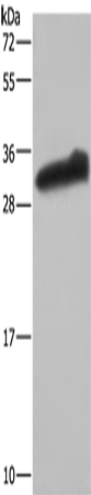 Western Blot analysis of Human testis tissue using GSTA3 Polyclonal Antibody at dilution of 1:250