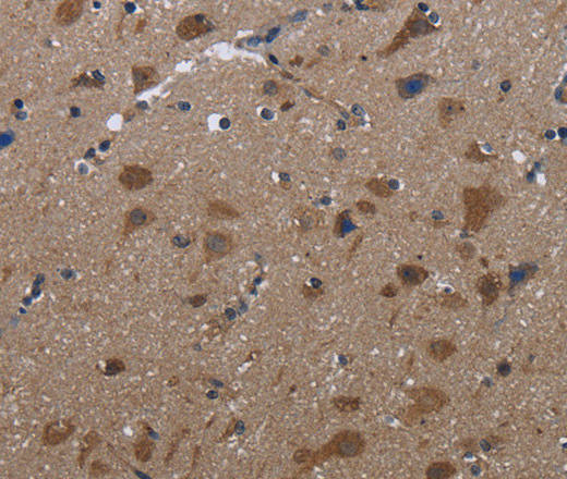 Immunohistochemistry of paraffin-embedded Human brain  tissue using LETMD1 Polyclonal Antibody at dilution 1:30