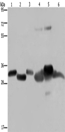 Western Blot analysis of Mouse thymus and Human ovarian cancer tissue, Mouse heart, Human fetal liver, Mouse liver tissue and SKOV3 cell   using HMGCL Polyclonal Antibody at dilution of 1:300