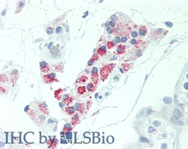 Immunohistochemistry of paraffin-embedded Human Testis, Leydig Cells using HSD17B8 Polyclonal Antibody at dilution of 1:100.