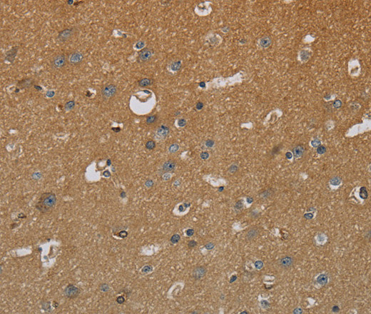 Immunohistochemistry of paraffin-embedded Human brain  tissue using HSD17B2 Polyclonal Antibody at dilution 1:50