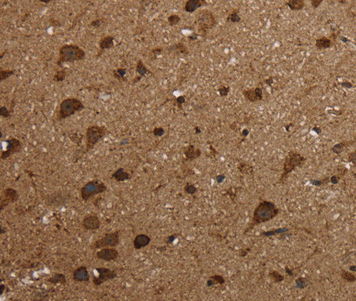 Immunohistochemistry of paraffin-embedded Human brain  using HSD17B13 Polyclonal Antibody at dilution of 1:30