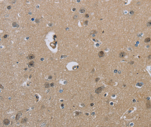 Immunohistochemistry of paraffin-embedded Human brain  using HSD3B1 Polyclonal Antibody at dilution of 1:40